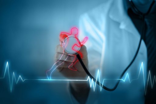 Più movimento, meno dolore